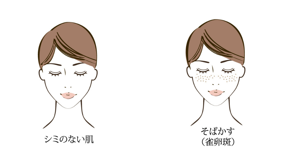 シミの原因と正しい対策法|今日からできる効果的な対策とは?