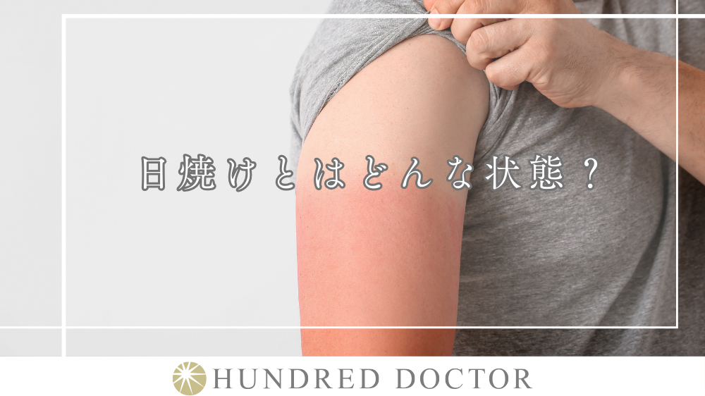 日焼けとはどんな状態?