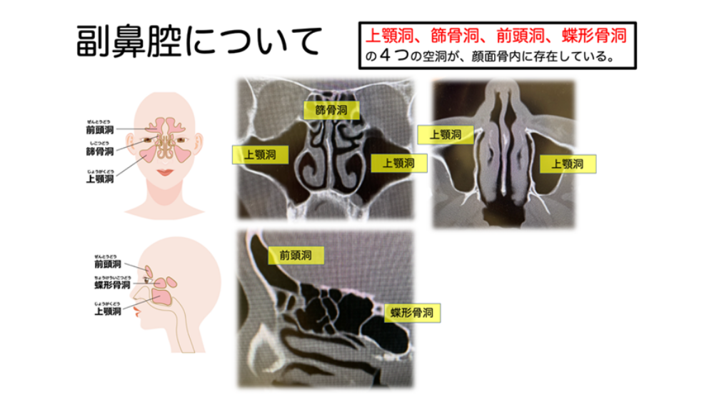 鼻詰まりの原因は?日常でできる解消方法や長引く場合の対処法を紹介