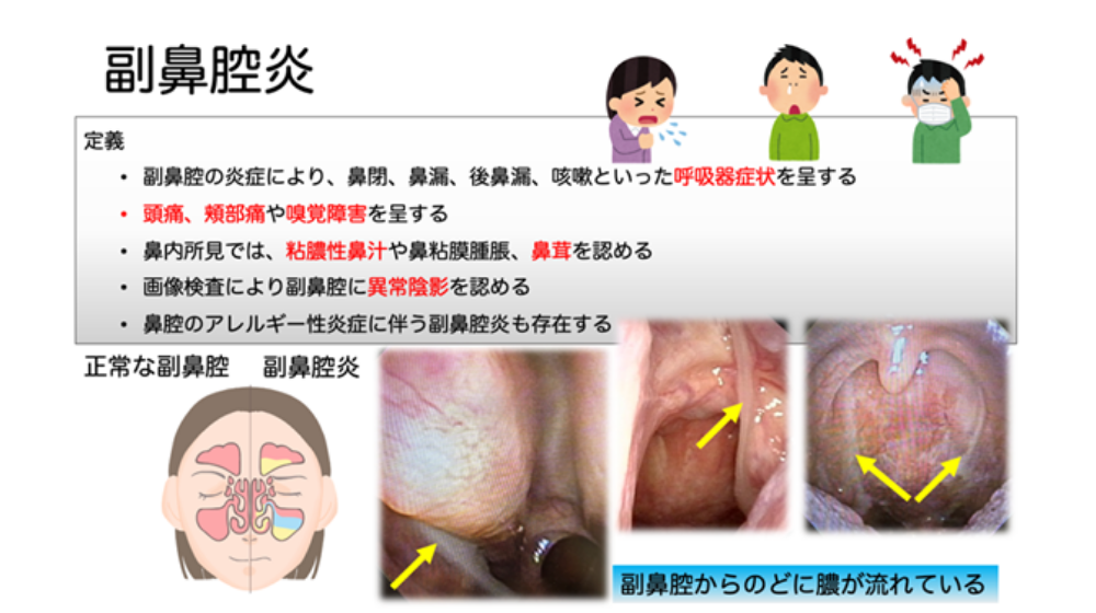 鼻詰まりの原因は?日常でできる解消方法や長引く場合の対処法を紹介