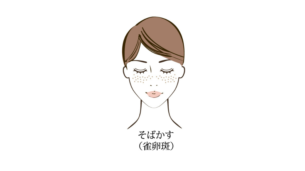 シミができやすい人の特徴とは?肌を守るための予防とスキンケア方法